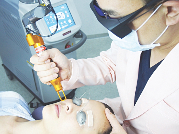 laser điều trị nám da