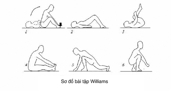 Điều trị và phòng ngừa đau thắt lưng