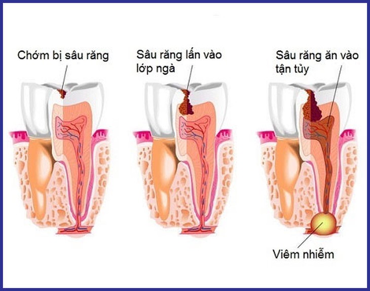 Những bài thuốc từ cây chanh