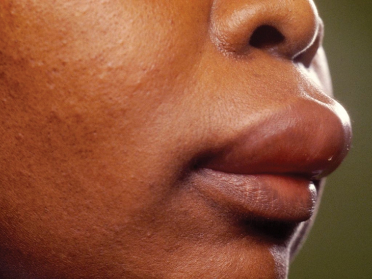 Phát hiện và điều trị bệnh do rối loạn thần kinh thực vật