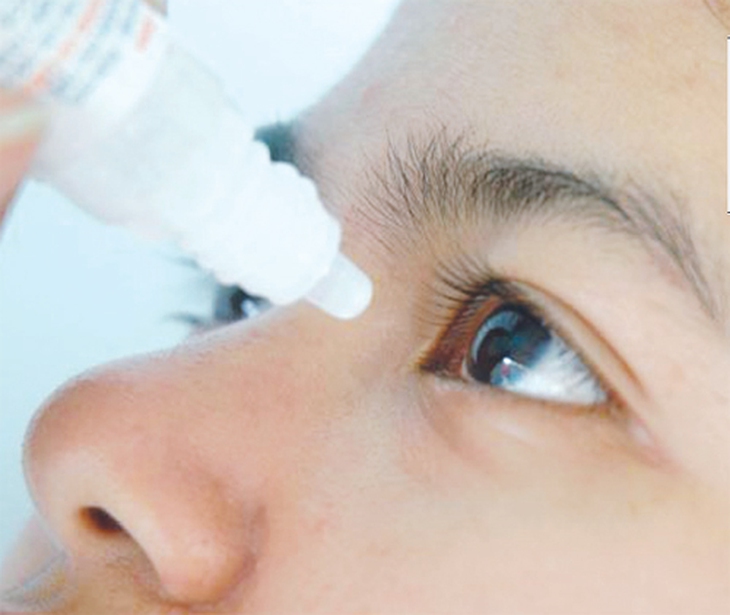 Nguy hại khi dùng thuốc nhỏ mắt không đúng