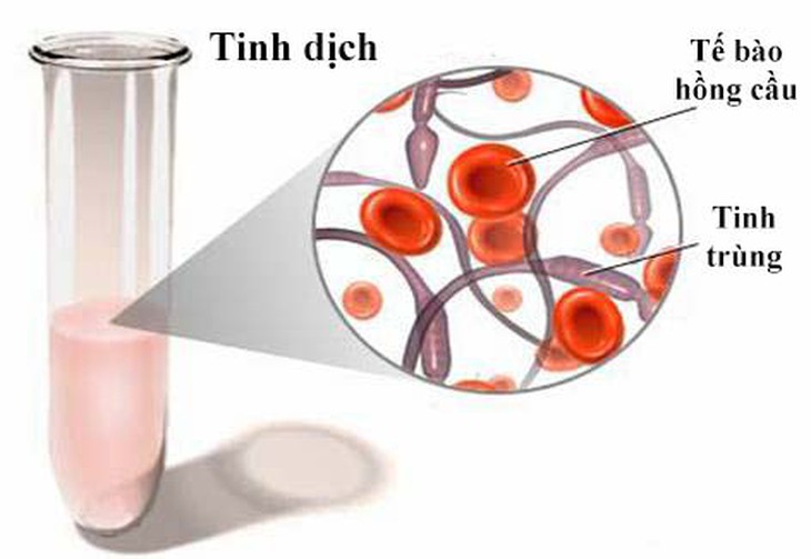 Cách ngừa và trị rối loạn xuất tinh