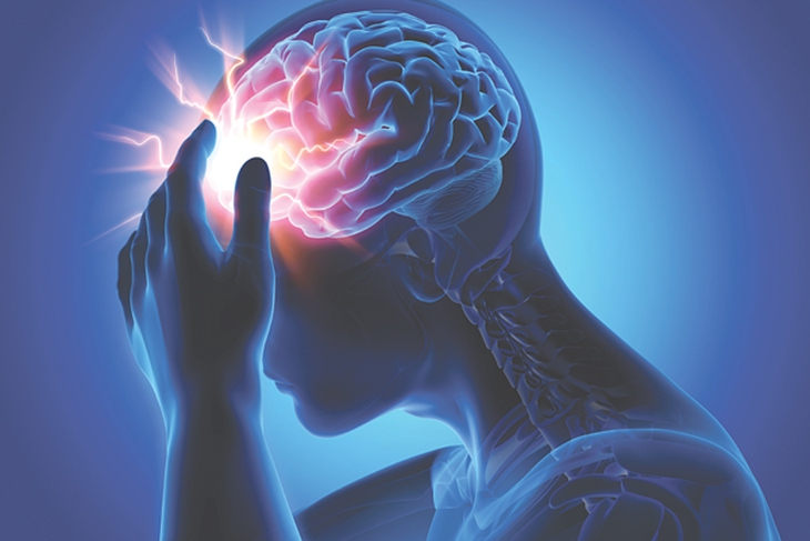 Đột quỵ ở người trẻ