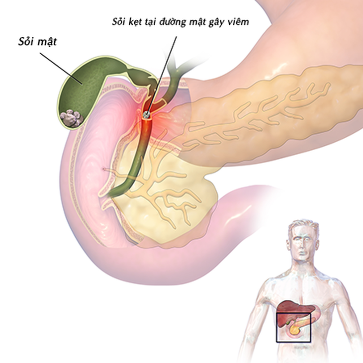 Rối loạn tiêu hóa
