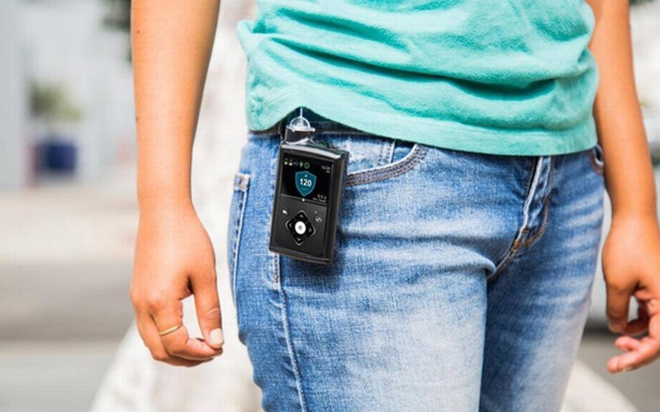 Khuyến cáo của FDA về sử dụng tuỵ nhân tạo cho nhóm đái tháo đường týp 1