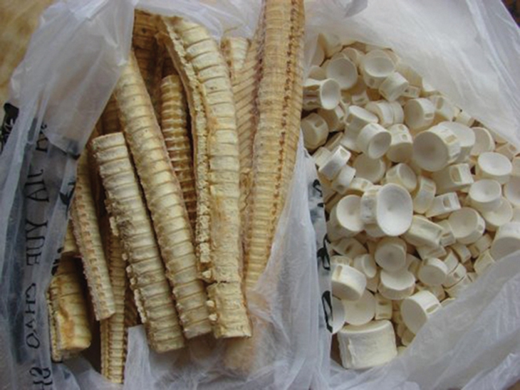 Những kiểu trị bệnh lạ nhất thế giới trong vòng 100 năm qua