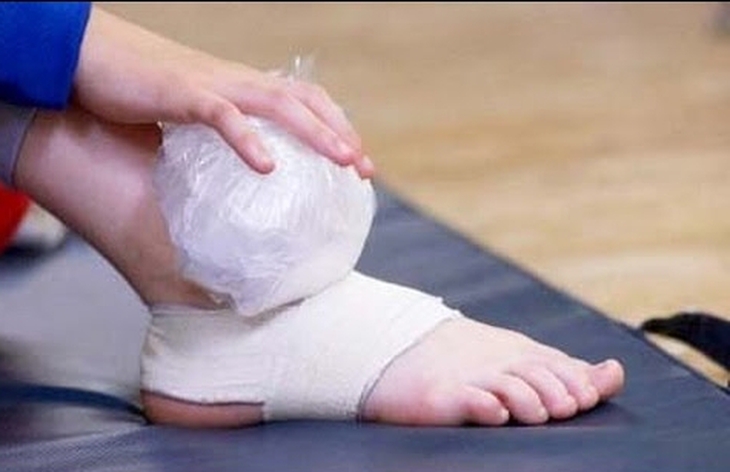 Xử trí khi bị bong gân