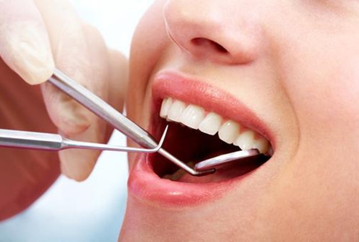Sau nhổ răng bao lâu thì cấy imlant?