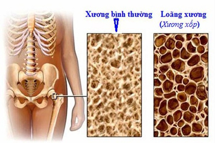 Những nguy cơ do lười tập thể dục