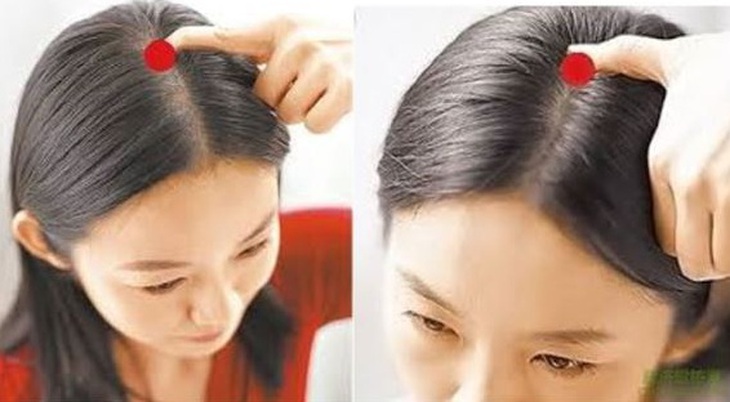 Phục hồi di chứng tai biến mạch máu não