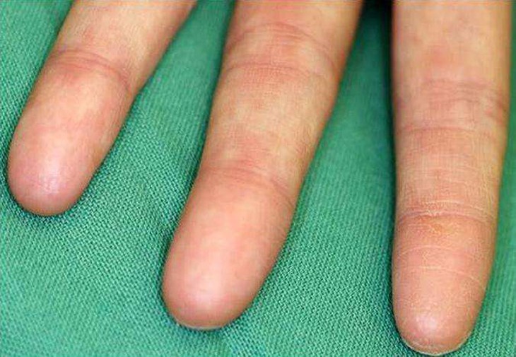 Người có khả năng kỳ lạ do lỗi... gene