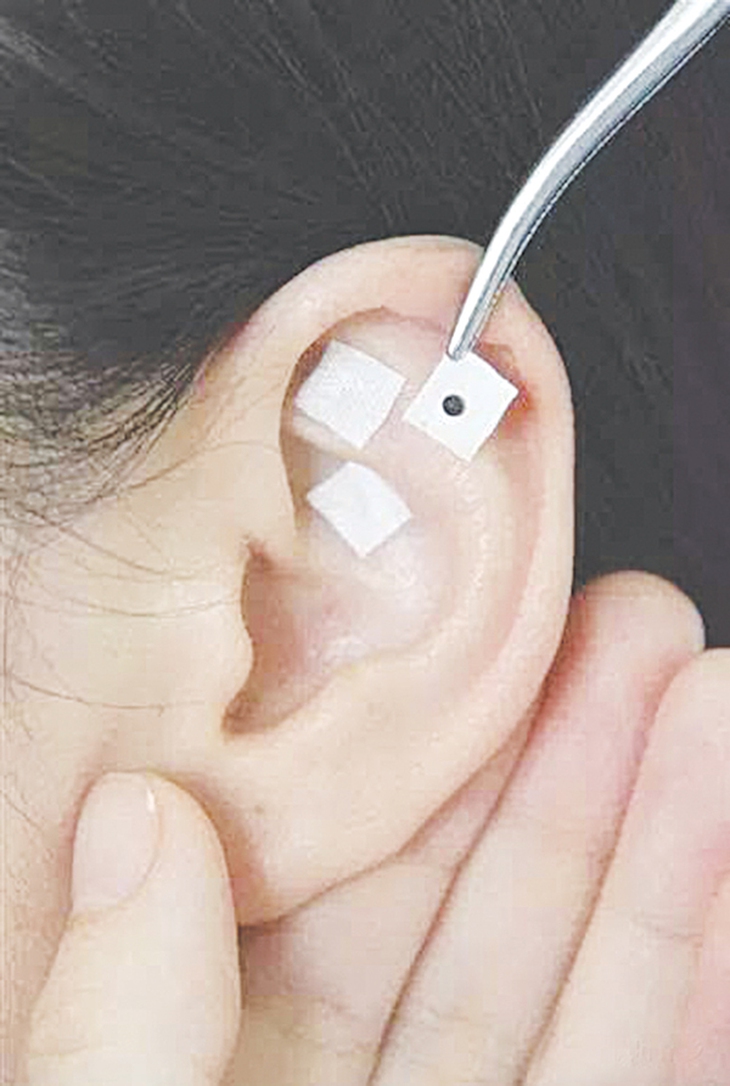 Dán hạt vương bất lưu hành