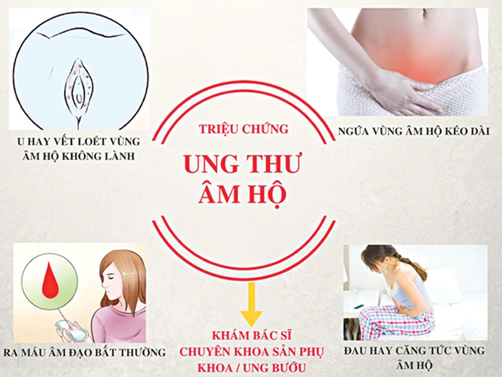 Ung thư âm hộ 