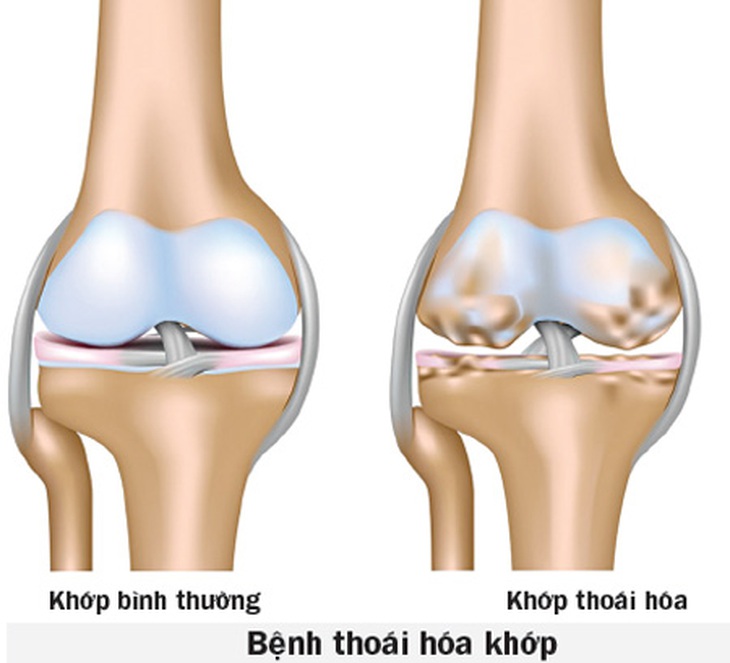 Vị thuốc chữa bệnh từ rắn
