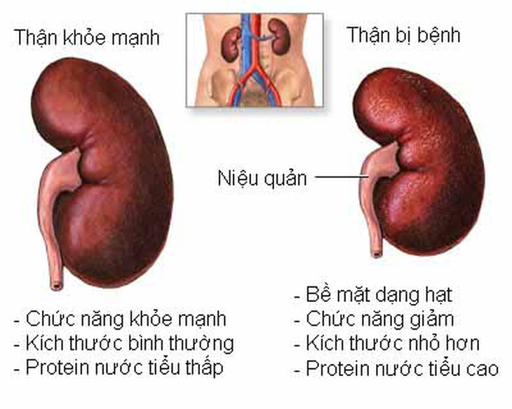 Bài thuốc chữa chứng mất ngủ