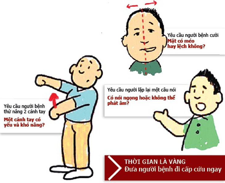 Cách phát hiện sớm đột quỵ