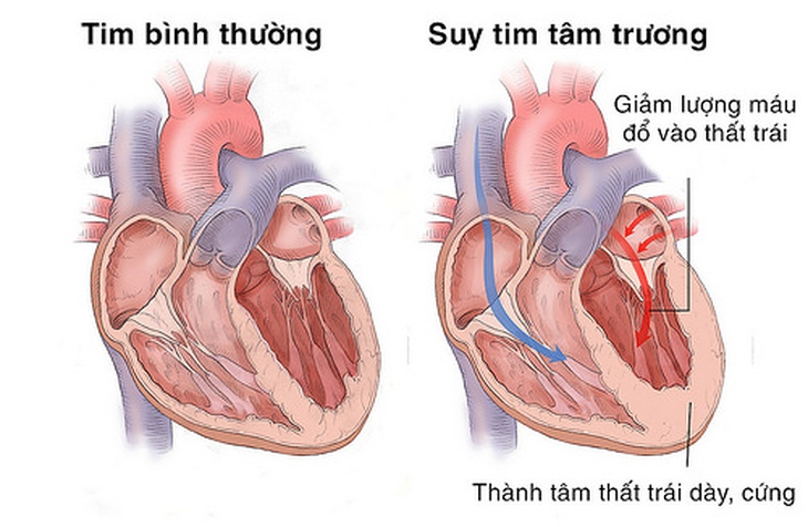 Ðối tượng dễ bị nhiễu loạn tâm thần