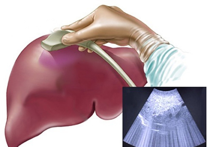 Khi gan, mật bị tổn thương…