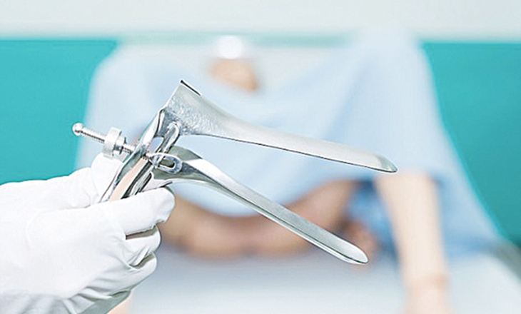 Hội chứng tiết dịch âm đạo