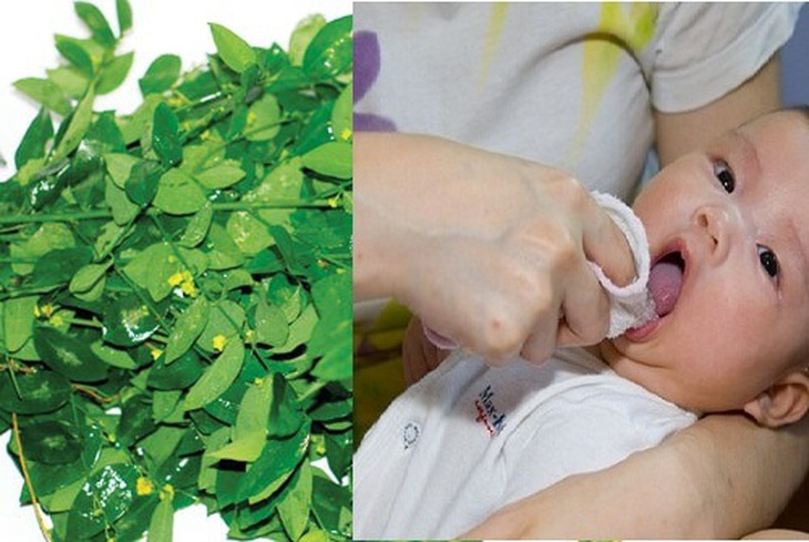 Rau ngót tươi giã vắt lấy nước, thấm vào gạc đánh vòm miệng và lưỡi chữa tưa lưỡi ở trẻ sơ sinh