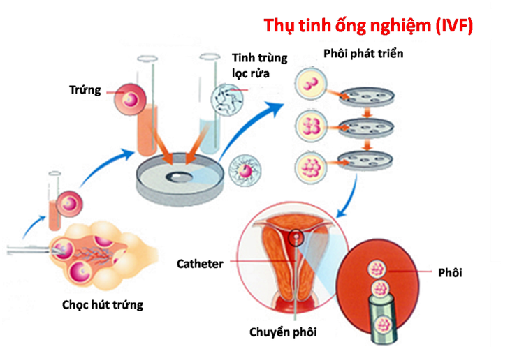 Thụ tinh nhân tạo và thụ tinh ống nghiệm