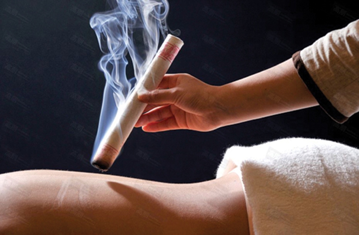 Cứu: Phương pháp điều trị hiệu quả  và độc đáo