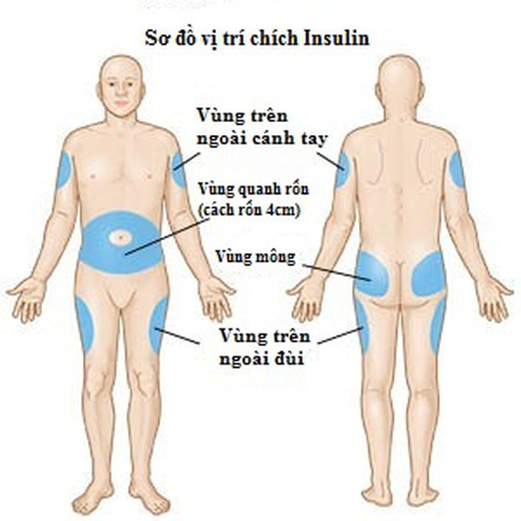 Insulin - Dùng thế nào cho đúng?