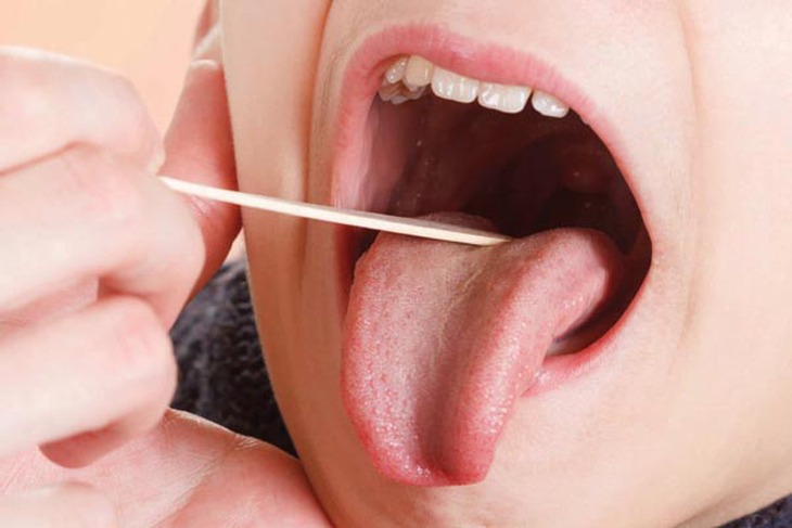 Amiđan không thể thấy viêm là muốn đi cắt