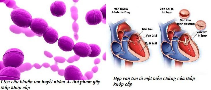 Thuốc trị và dự phòng tái phát thấp khớp cấp