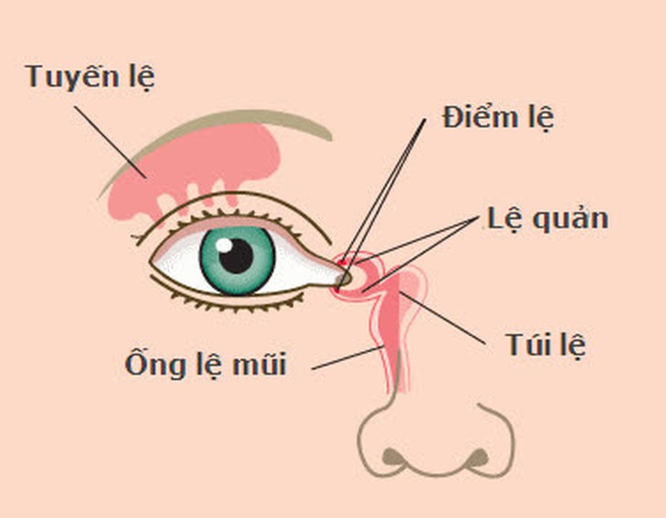 Nhận biết, xử lý tắc tuyến lệ ở trẻ
