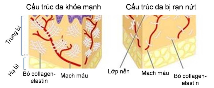 Thời tiết lạnh ảnh hưởng tới da như thế nào?