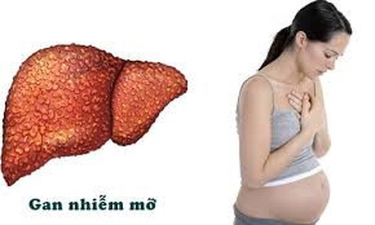 Ðối phó với bệnh gan trong thai kỳ
