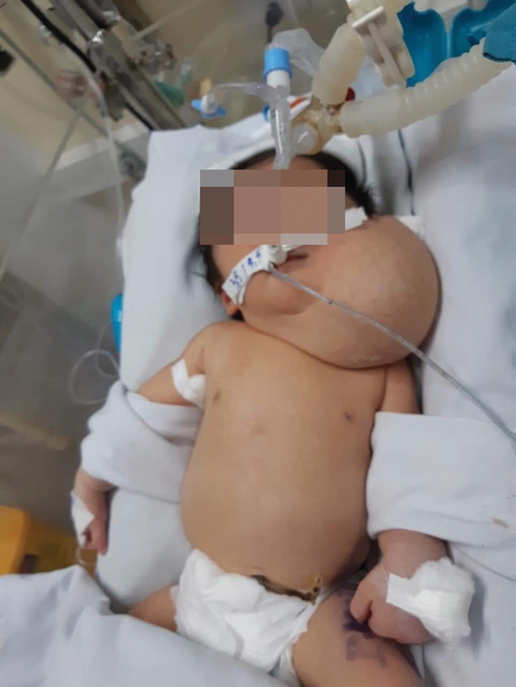 Phối hợp sản nhi 