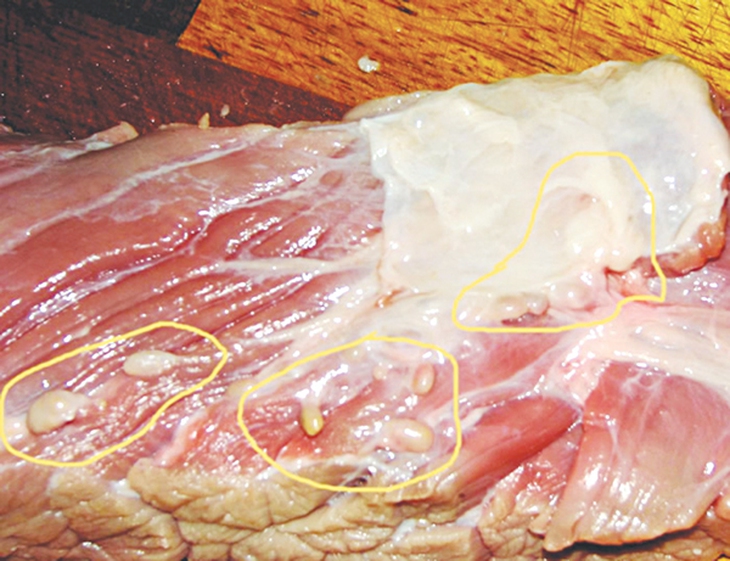 Thực hư về bệnh sán dây!