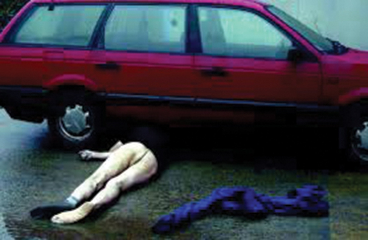 Hypothermia Undressing án mạng hay tử vong vì hạ thân nhiệt