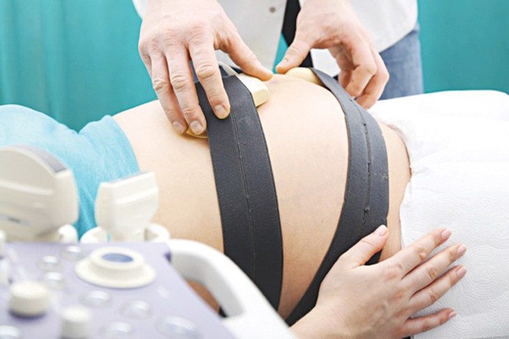 Ý nghĩa của việc theo dõi cơn co tử cung và nhịp tim thai