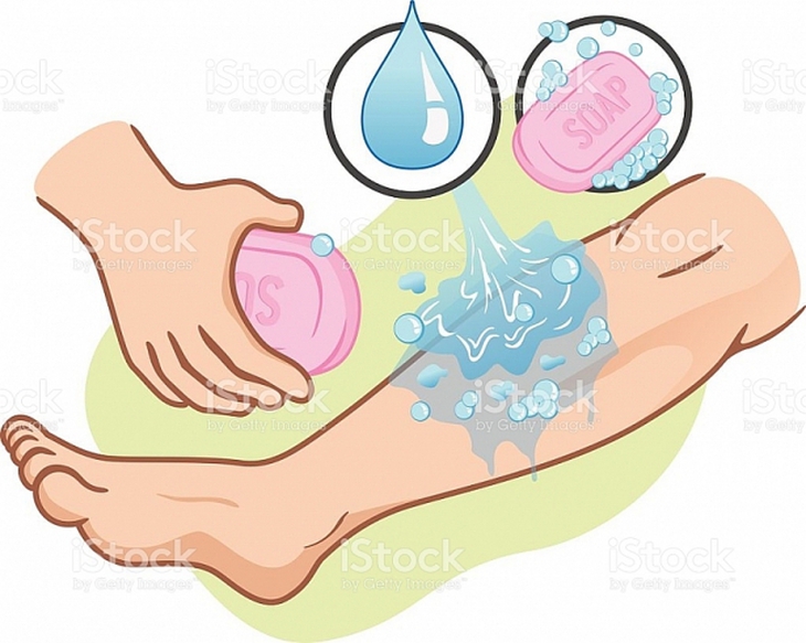 Bệnh dại và cách phòng tránh