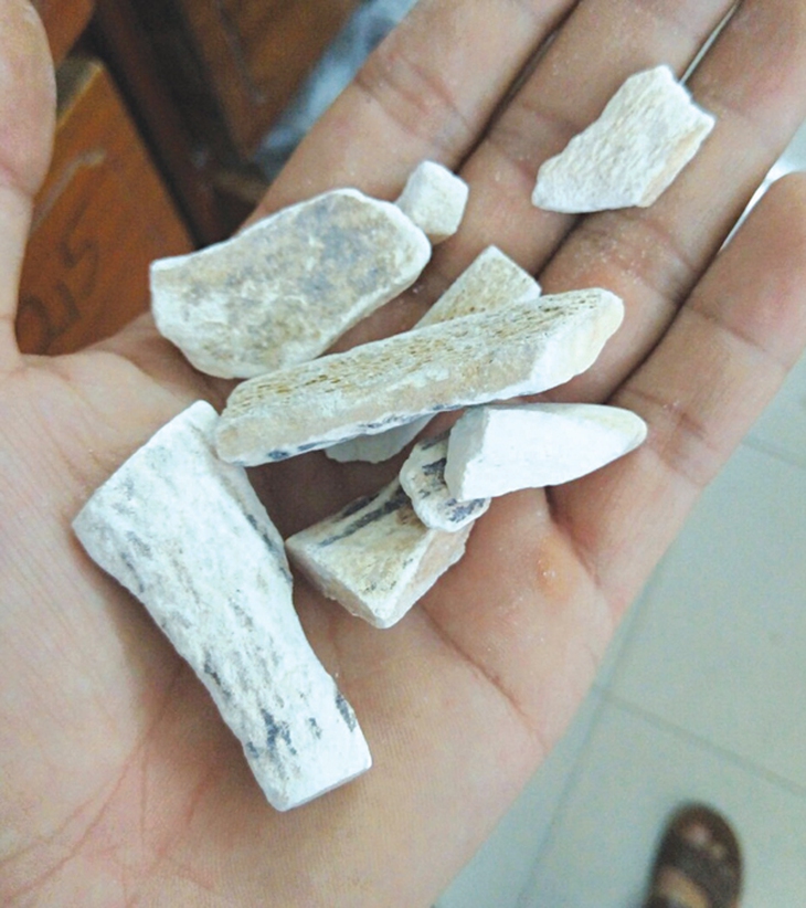 Huyết trắng ra nhiều, nên tẩm bổ như thế nào?