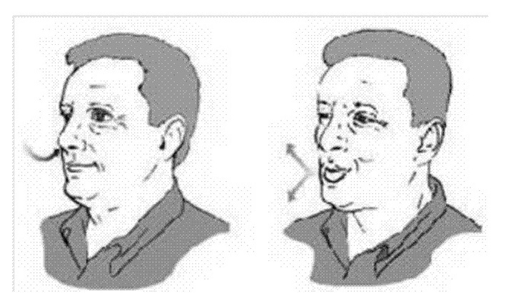 Giúp người bệnh COPD  thở dễ dàng hơn