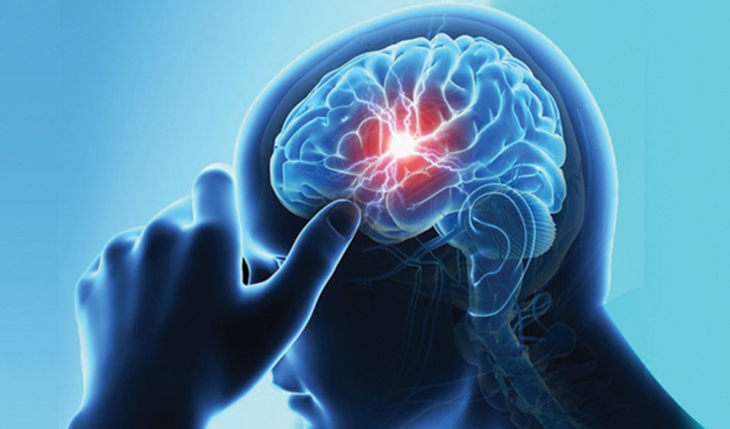 Chế độ ăn cho người bị đột quỵ