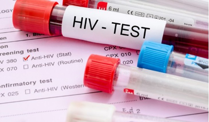 Cùng hành động để kết thúc dịch AIDS