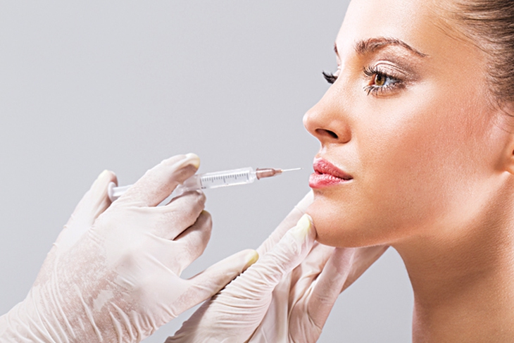 10 điều cần biết trước khi muốn tiêm chất làm đầy