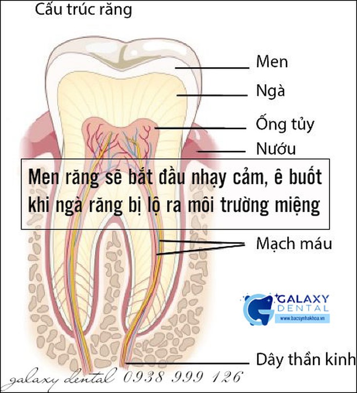 Răng ê buốt và cuộc chiến chống ê buốt