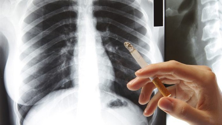 Ðối phó với “tác dụng phụ” sau bỏ thuốc lá