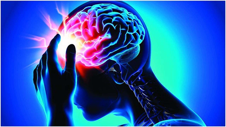 Tai biến mạch máu não, gây đột quỵ