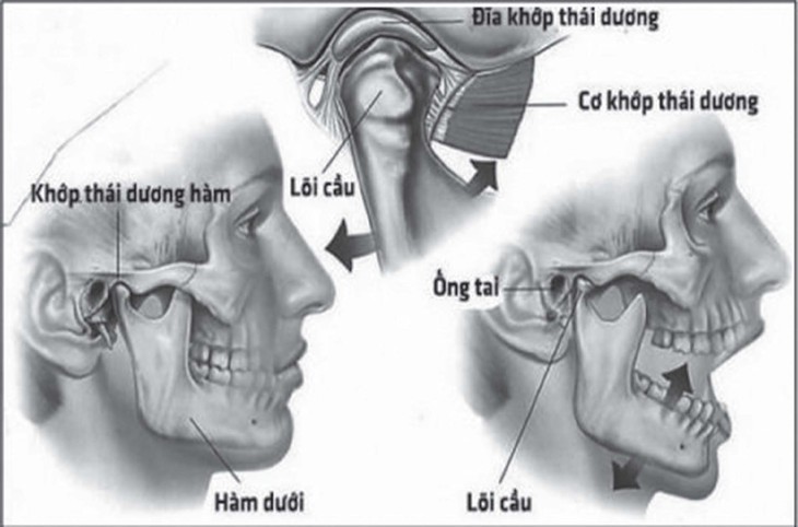 Biện pháp khắc phục đau khớp thái dương hàm tại nhà hiệu quả