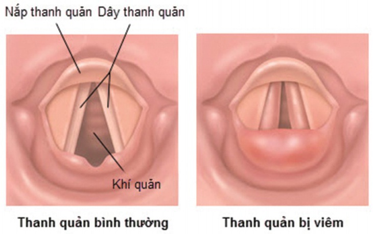 Nước mía lợi niệu, nhuận phế