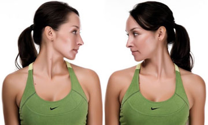 7 bài tập khi bị thoát vị đĩa đệm cột sống cổ
