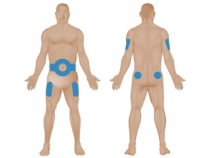 Tiêm insulin 