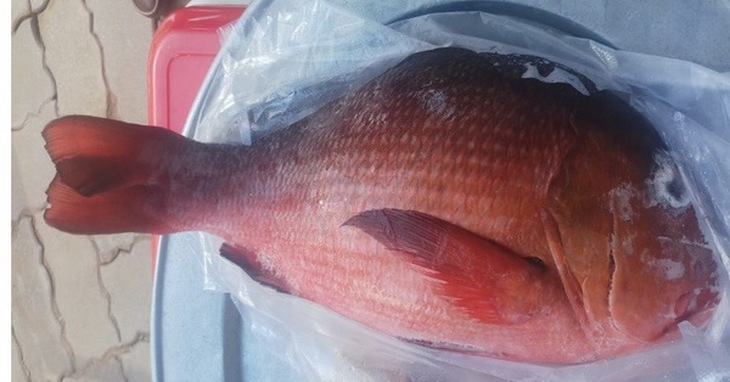 ngộ độc hải sản lạ